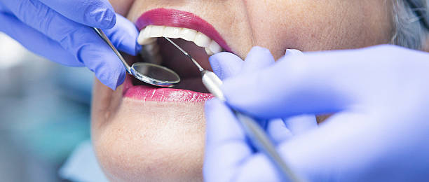Best Emergency Wisdom Tooth Extraction in Waikapu, HI